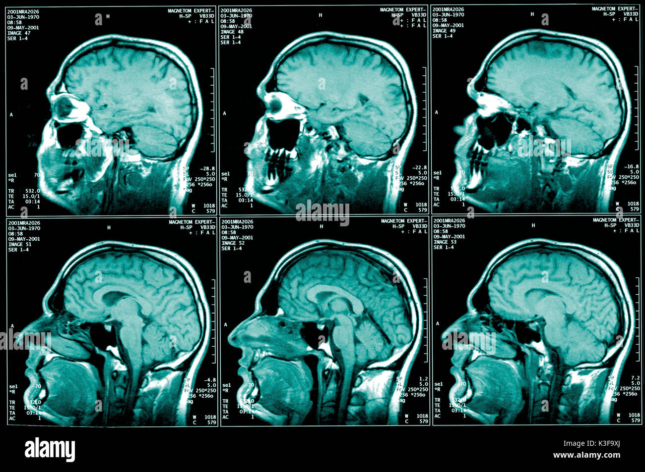 nuclear magnetic resonance imaging, magnetic resonance imaging Stock Photo