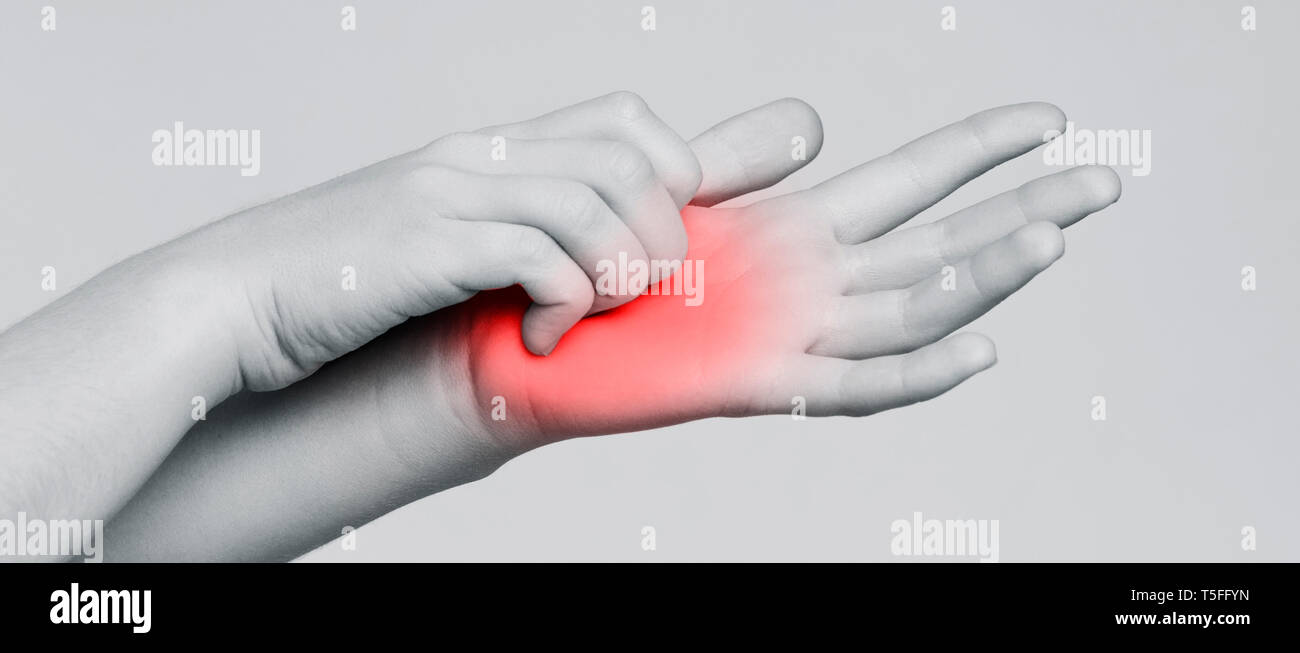 Young woman scratching itch on her hand Stock Photo