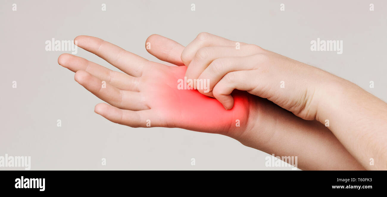 Woman scratching her itchy palm with rash Stock Photo