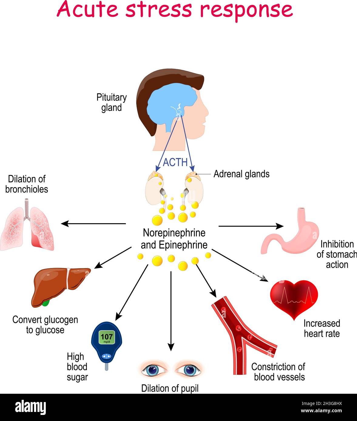 Risposta allo stress acuto. Reazione del sistema endocrino. Ormoni (norepinefrina, epinefrina, ACTH) e organi bersaglio (cuore, polmoni, fegato, occhi, sangue Illustrazione Vettoriale