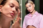 hailey bieber barefaced perioral dermatitis flare up