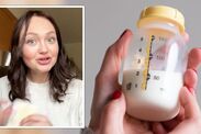 breast milk on face botox