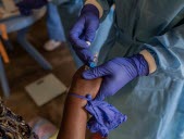 Mpox : les premiers vaccins arriveront dans les prochains jours