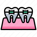 braces, dental, dentist, teeth, tooth