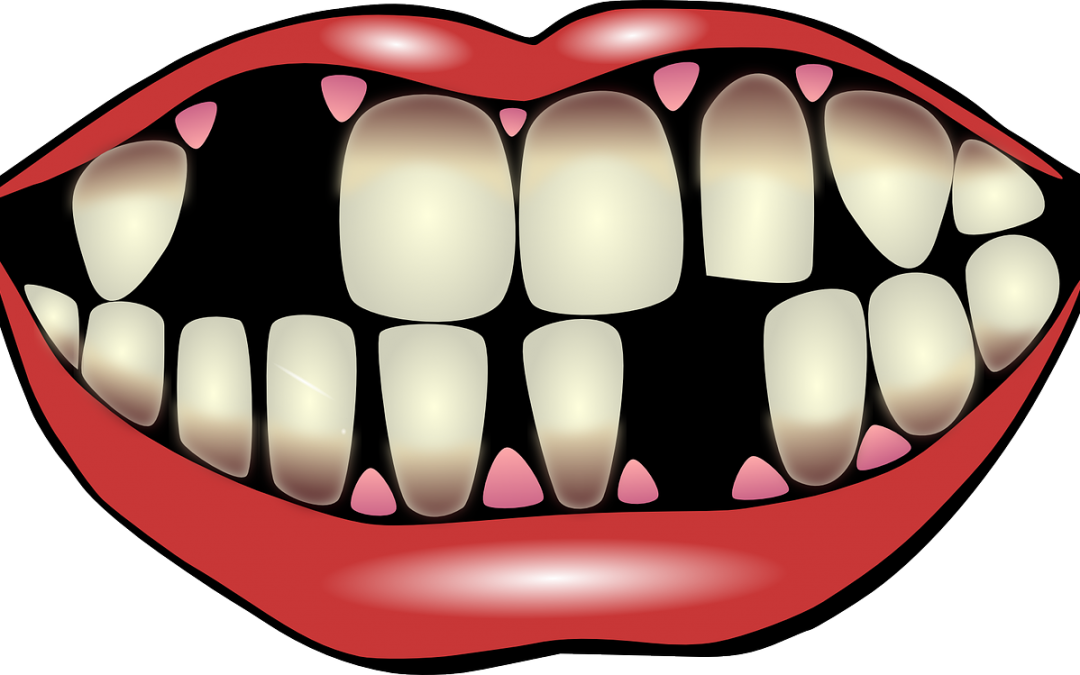 Tooth clipart gum disease, Tooth gum disease Transparent.