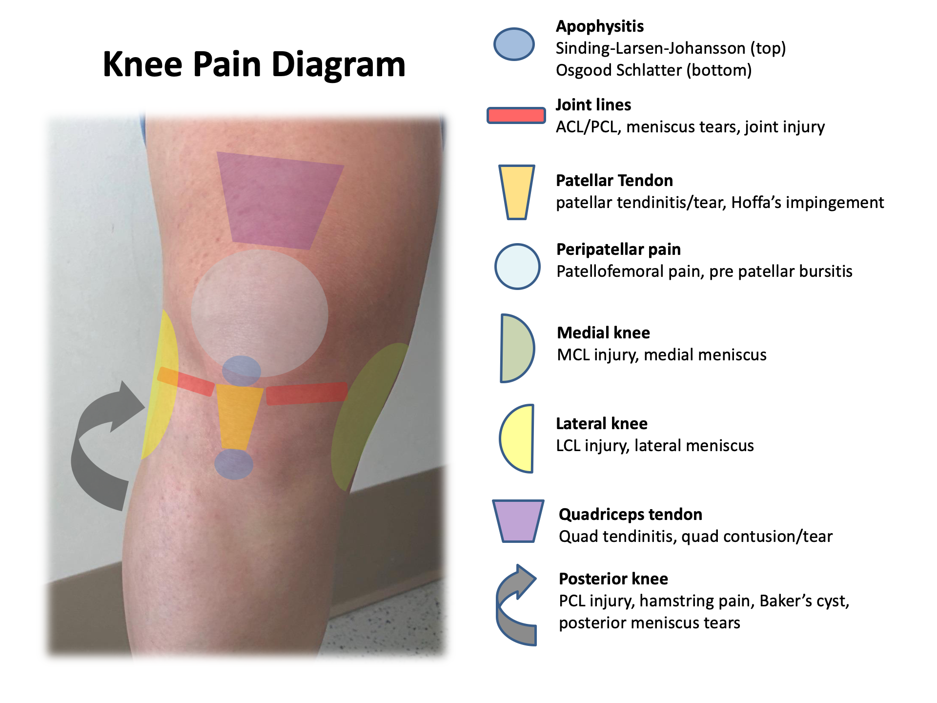 Knee Anatomy Chart