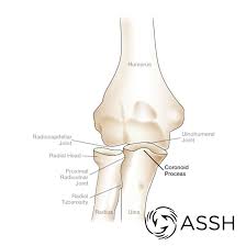 This is an online quiz called human anatomy: Body Anatomy Upper Extremity Bones The Hand Society