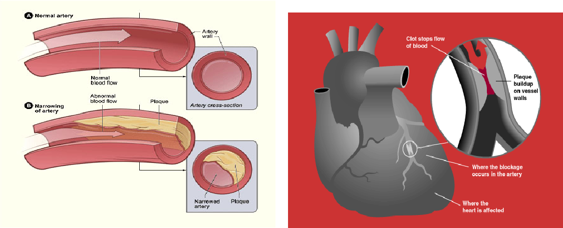 figure 1.1