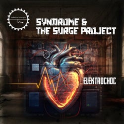 Elektrochoc