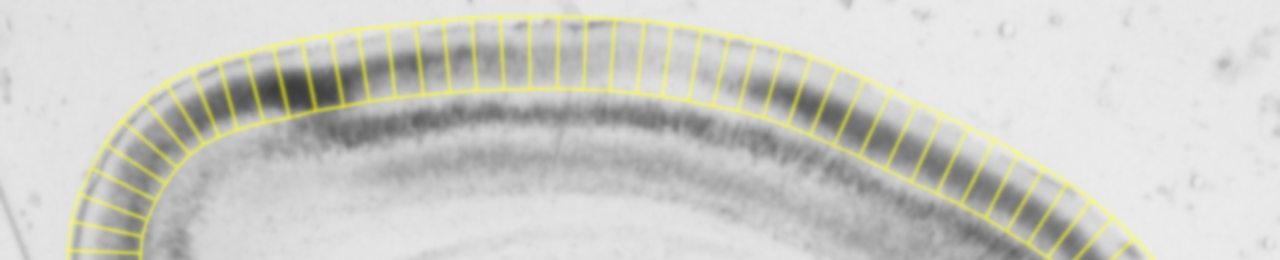 A banner image of a set of sample boxes laid out on a ISH brain slice image