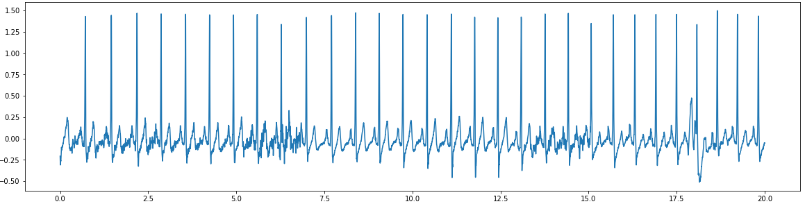 ECG Sample