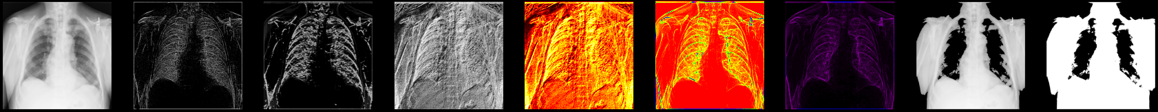 A series of 9 x-ray images of the same region of a patient's chest is shown with different types of image processing filters applied to each image. Each x-ray shows different types of biological detail.