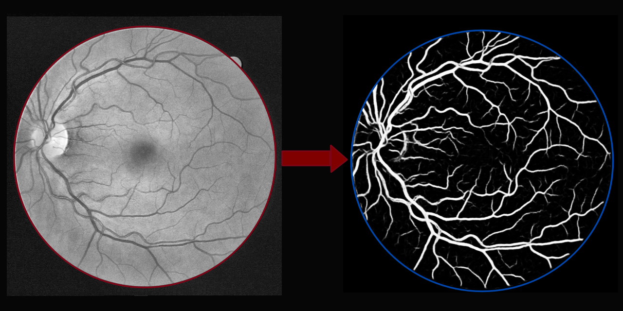 Retina Blood Vessel Segmentation