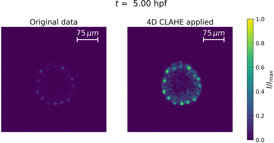 MCLAHE applied to fluorescence microscopy data