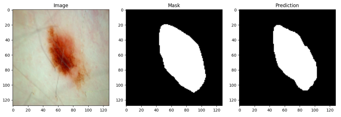 Segmentation result