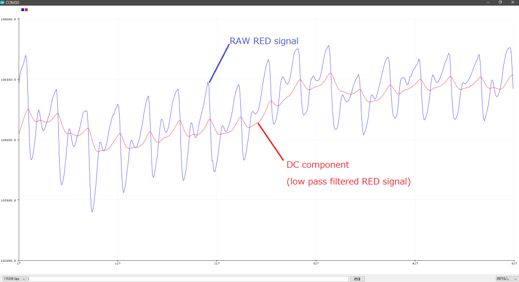 Fig.4 Raw RED signal - DC(low pass filtered RED) 