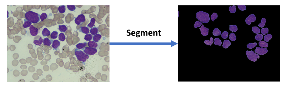 Fig 1. An example image for overlapping cell segmentation.