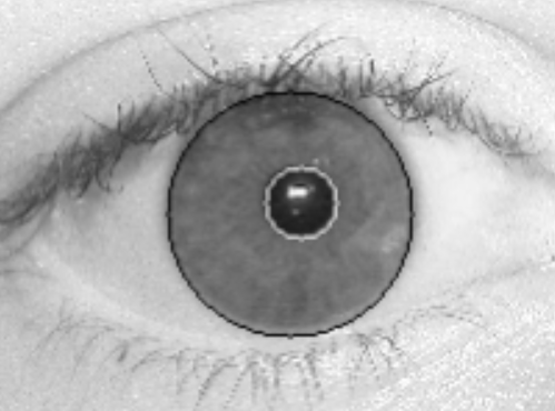 eye_img