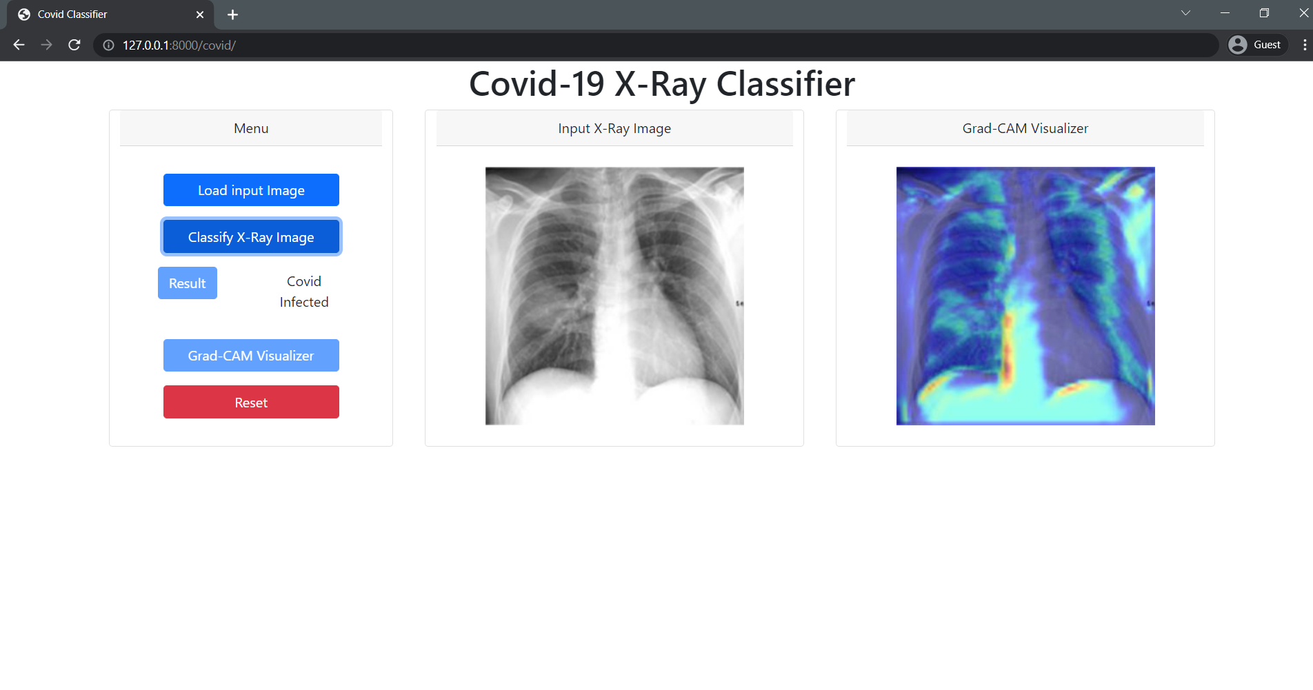 Covid Prediction