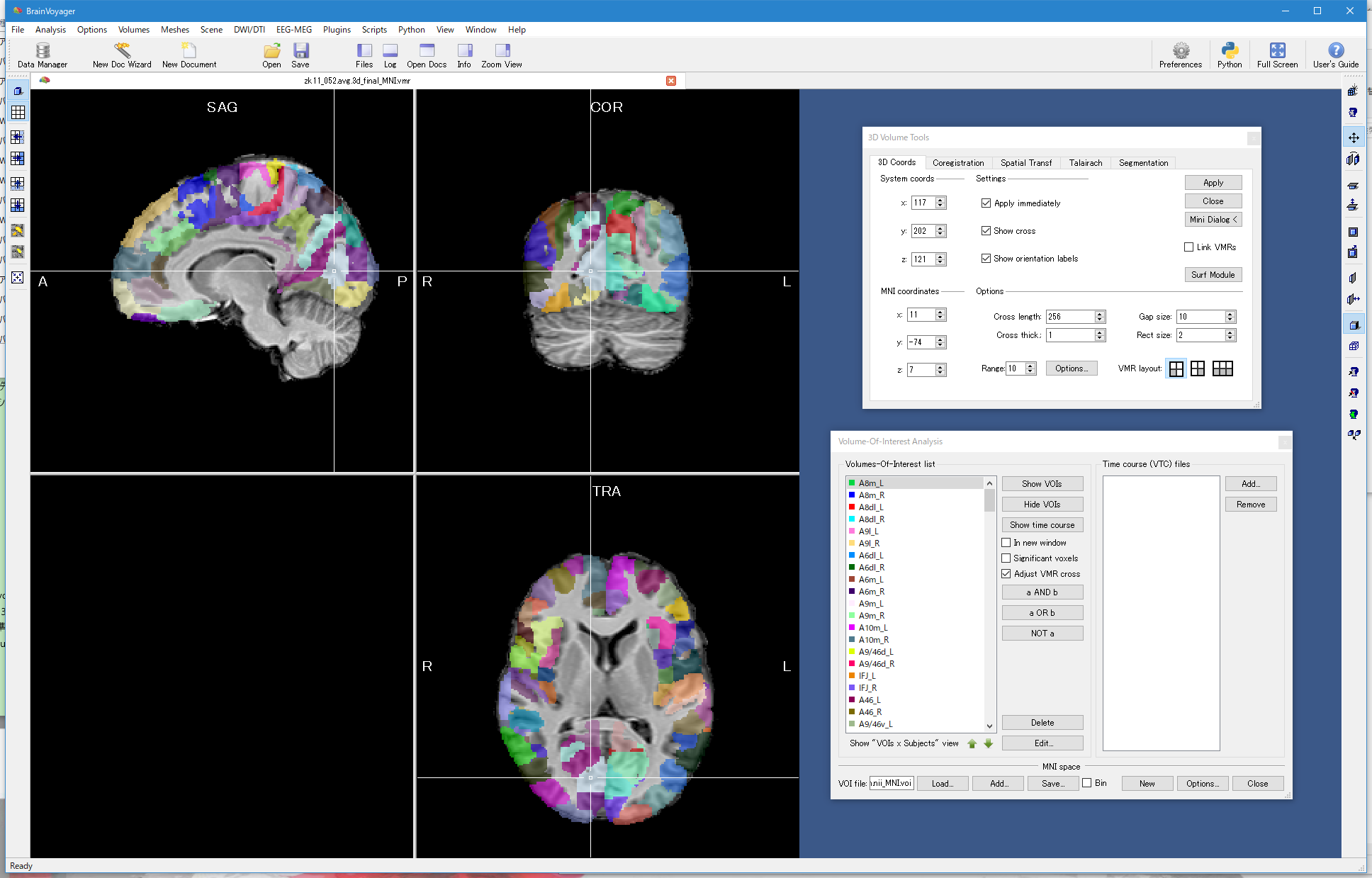 Brainnetome