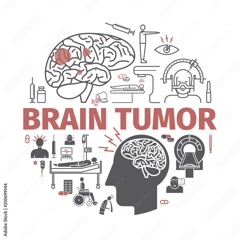 Brain_tumor