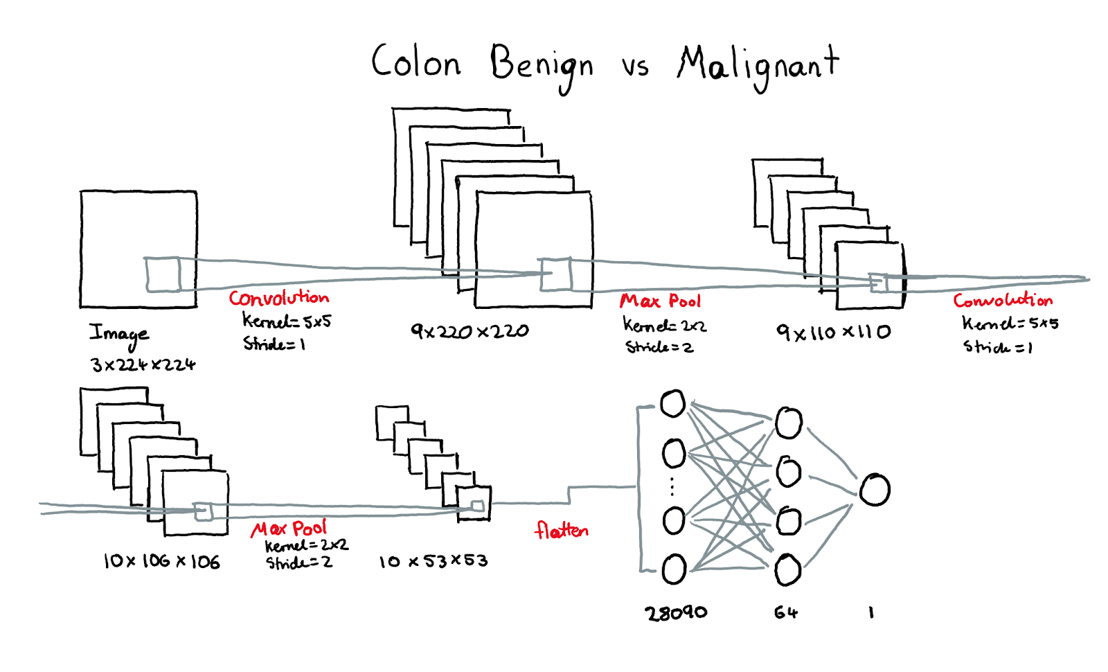 CNN #3 - Colon Benign vs. Malignant Architecture