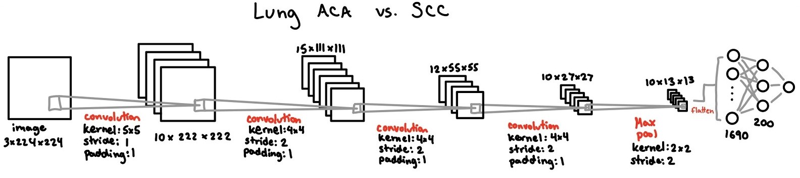 CNN #4 - Lung Malignant SCC vs. ACA Architecture