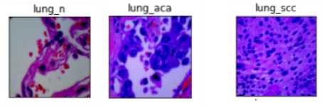 Data Visualization: Lung Samples