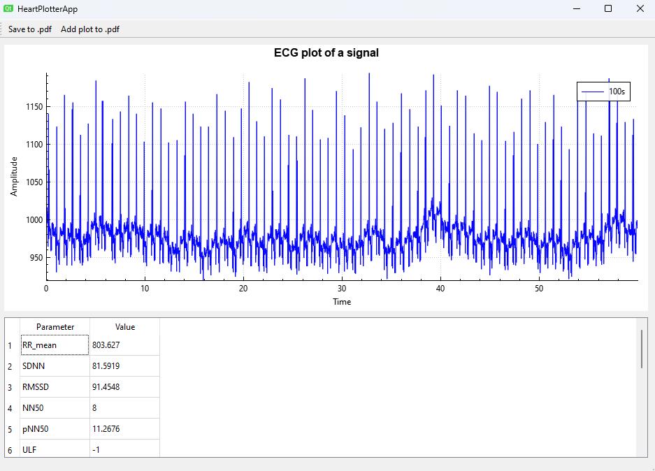 Picture with main page of the application, consisting of the plot with ECG signal, table with calculated diagnostc data and buttons responsible for saving the plot to .pdf file.