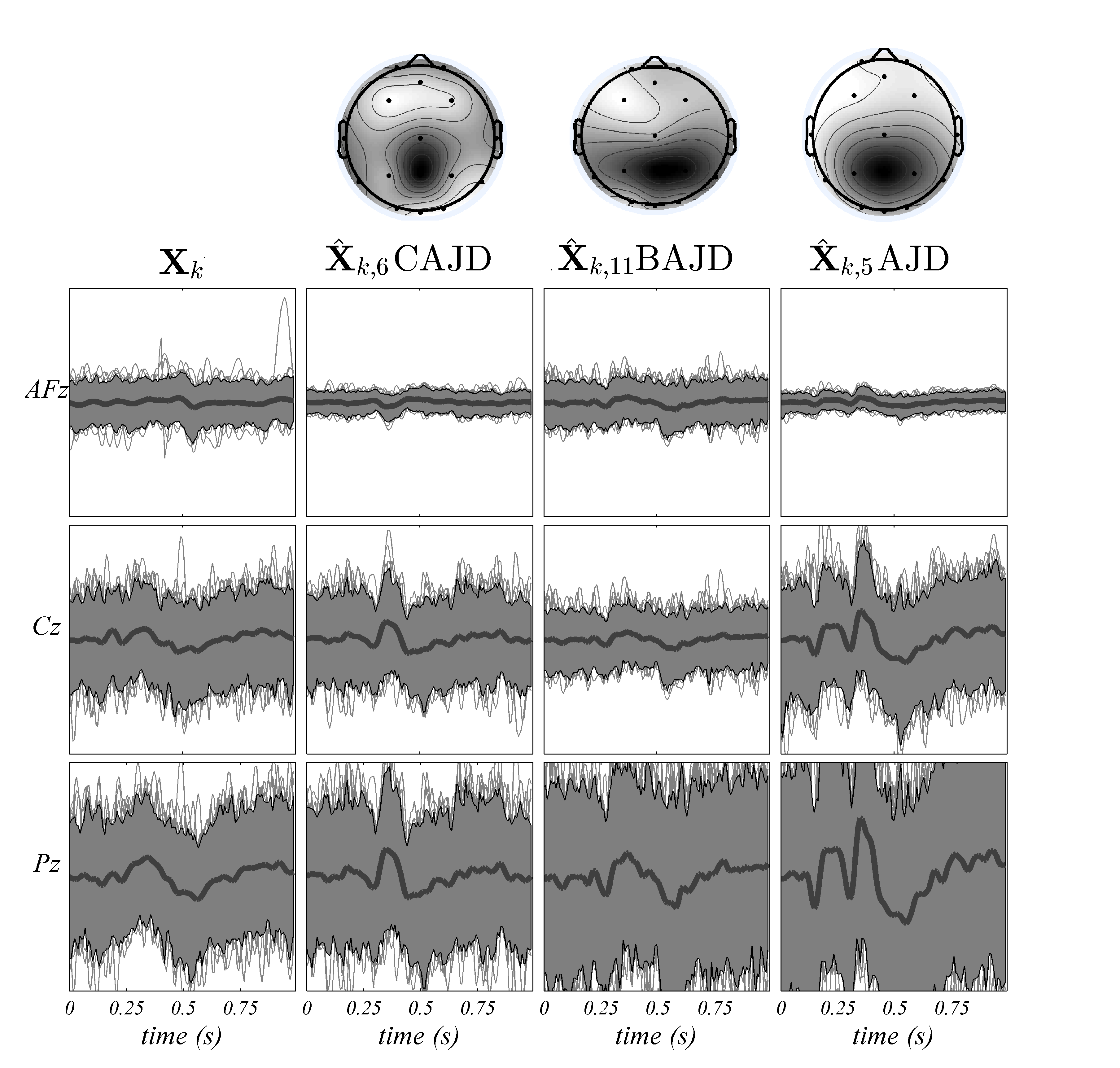 eeg sources comparison