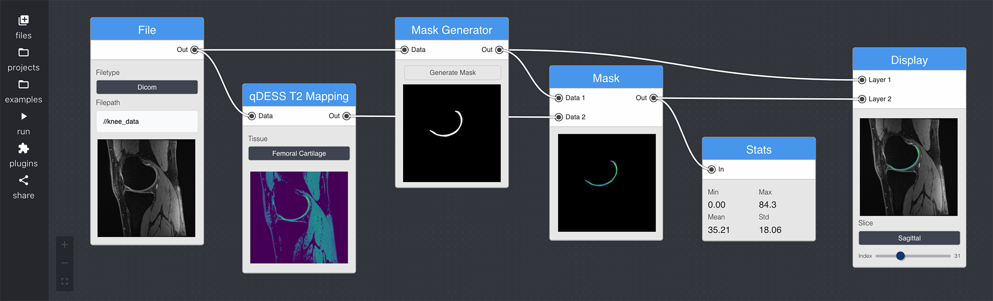 nodestudio example pipeline