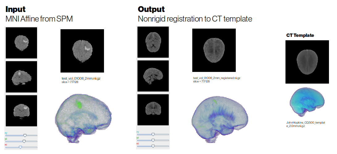 CT example