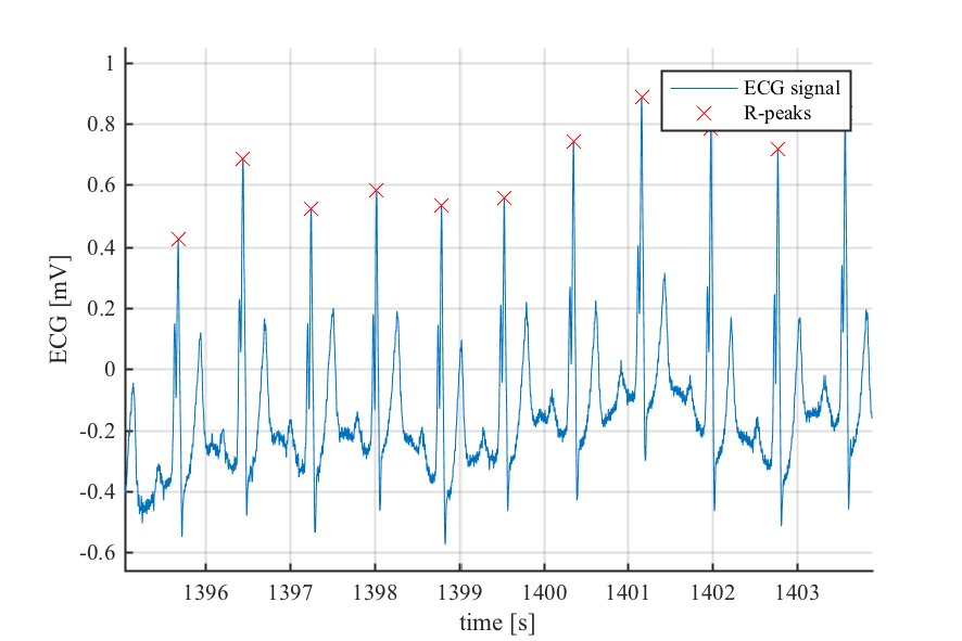 Example Peak Detection