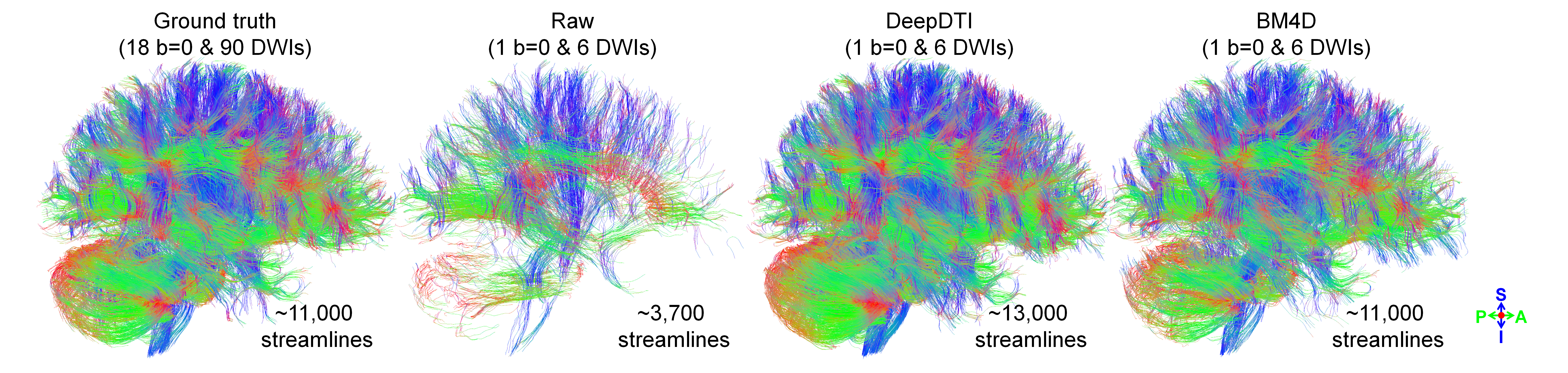 Comparison of tractography results