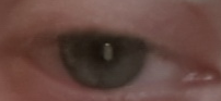 Segmented Eye Image 1