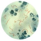 Streptococcus pyogenes