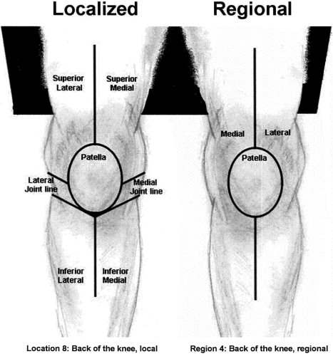 Knee diagram | Healthiack