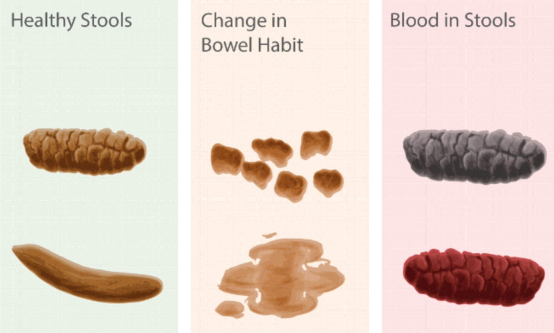 color of your poop chart stool color changes and chart what does it ...