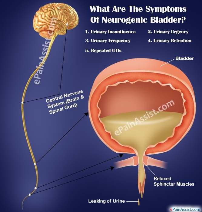 Bladder Diseases - Pictures