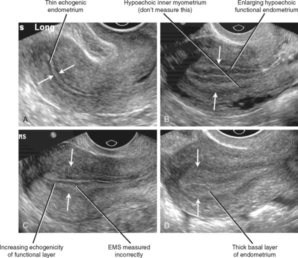 Vascular Ultrasound, Ultrasound Sonography, Radiology Imaging, Medical ...