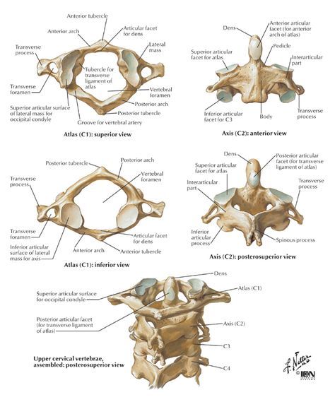 Pin on joints & back problems