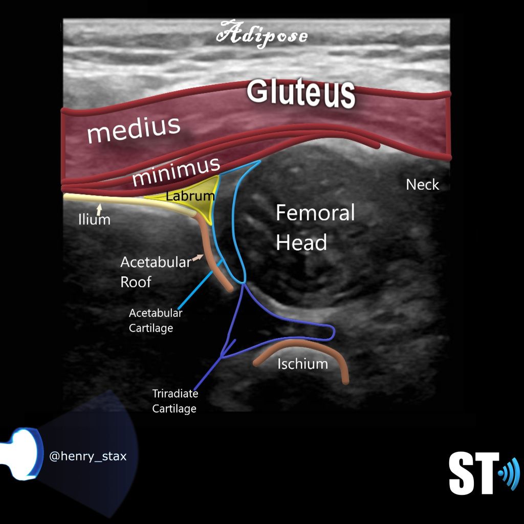 Ultrasound School, Baby Ultrasound, Ultrasound Pictures, Ultrasound ...