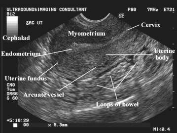 Fetal Anomalies Associated With Breech Presentation Ultrasound School ...