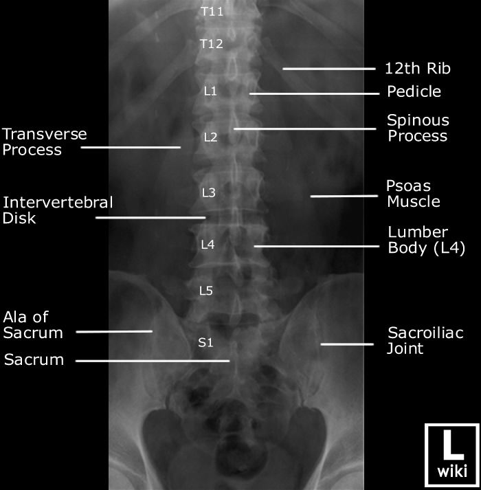 Labeled Lateral Lumbar Vertebrae