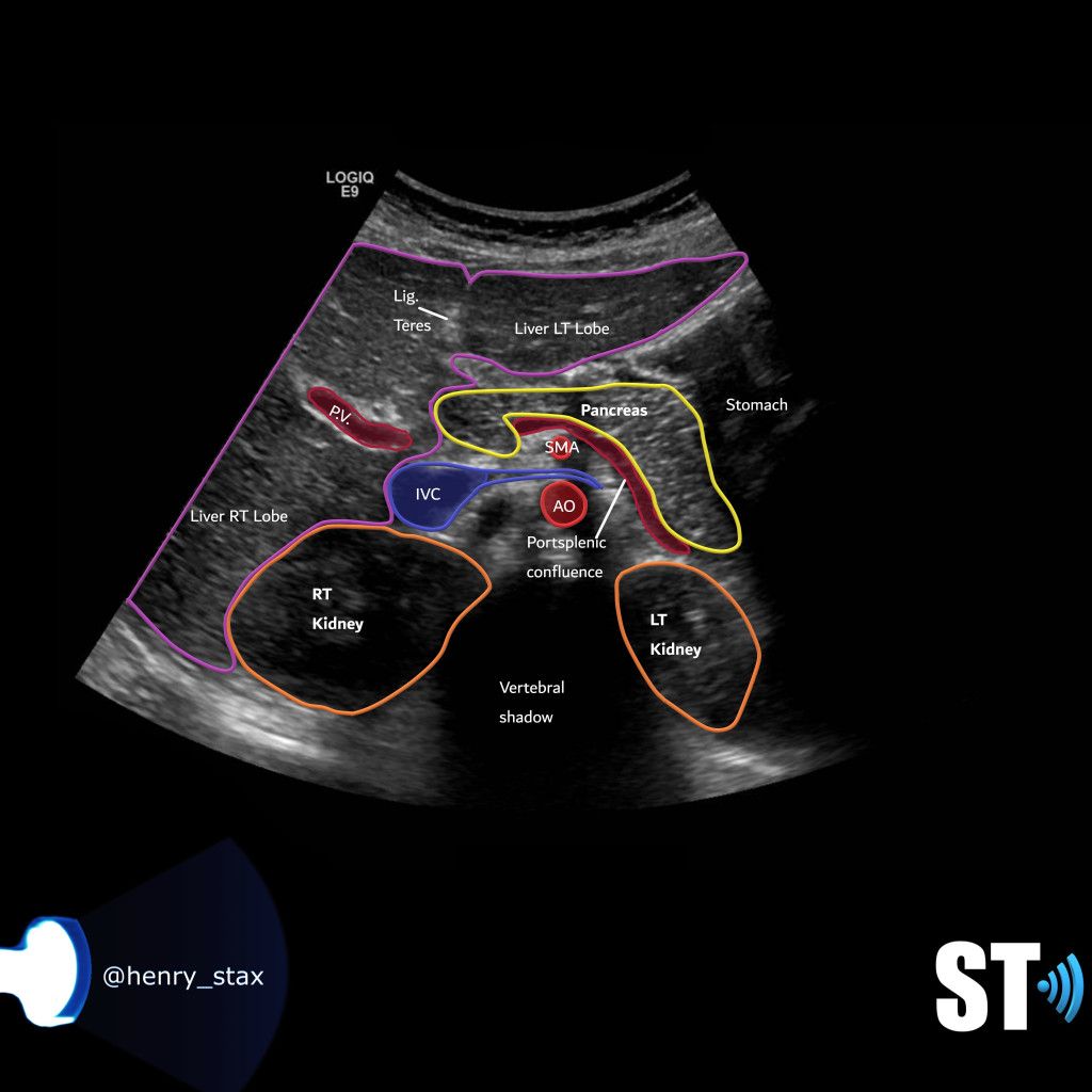 Liver Ultrasound Liver Anatomy Ultrasound Sonography Ct Scan Medical ...