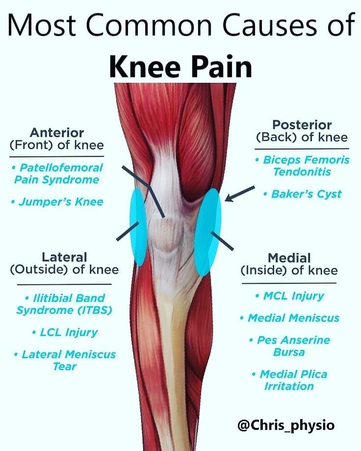 Outer Knee Pain Location Chart