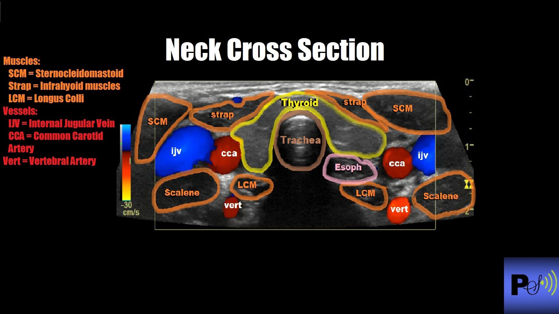 Labeled Thyroid Ultrasound