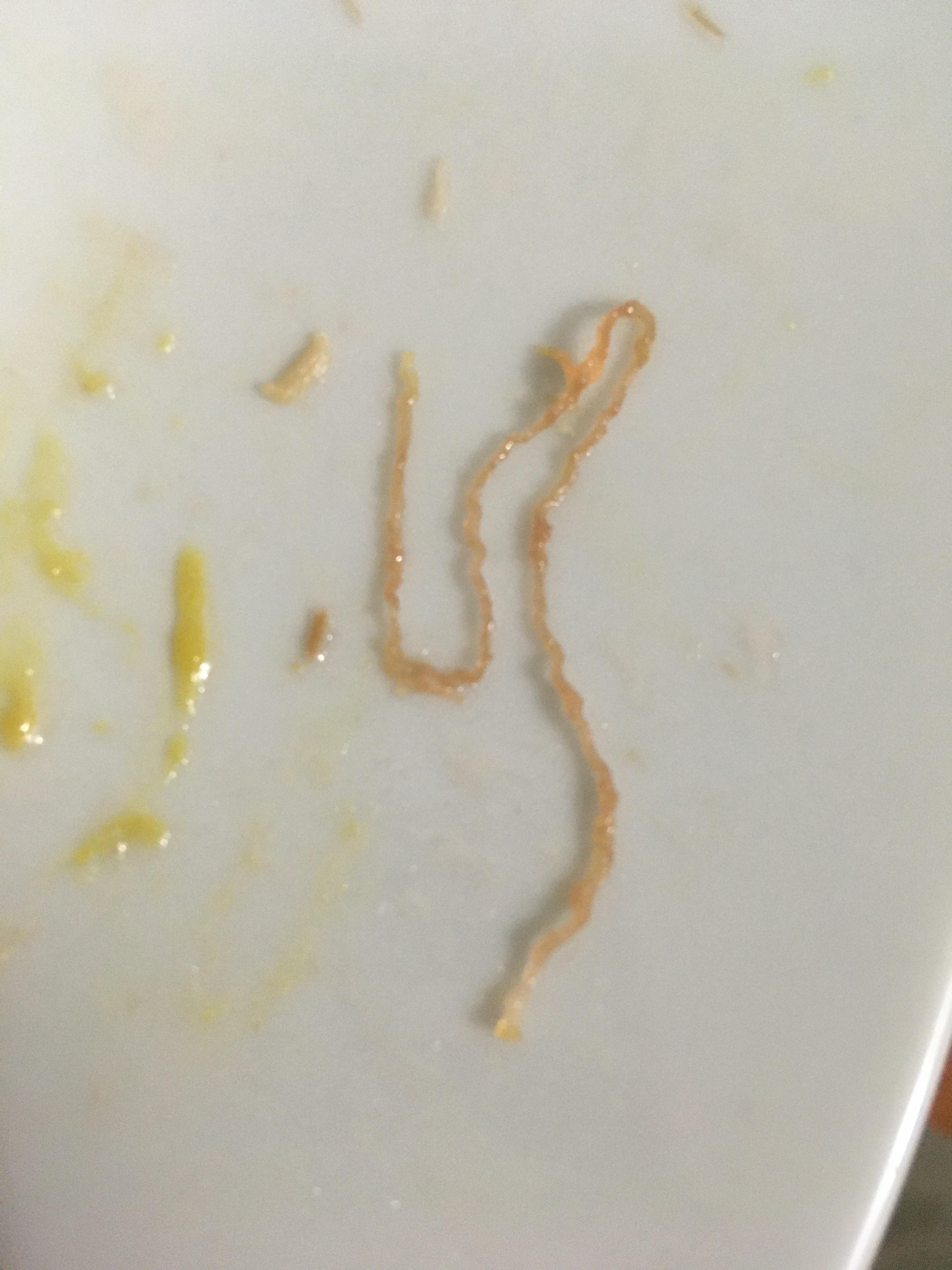 Noticed this while eating steelhead trout from Aldi. Is this a worm ...