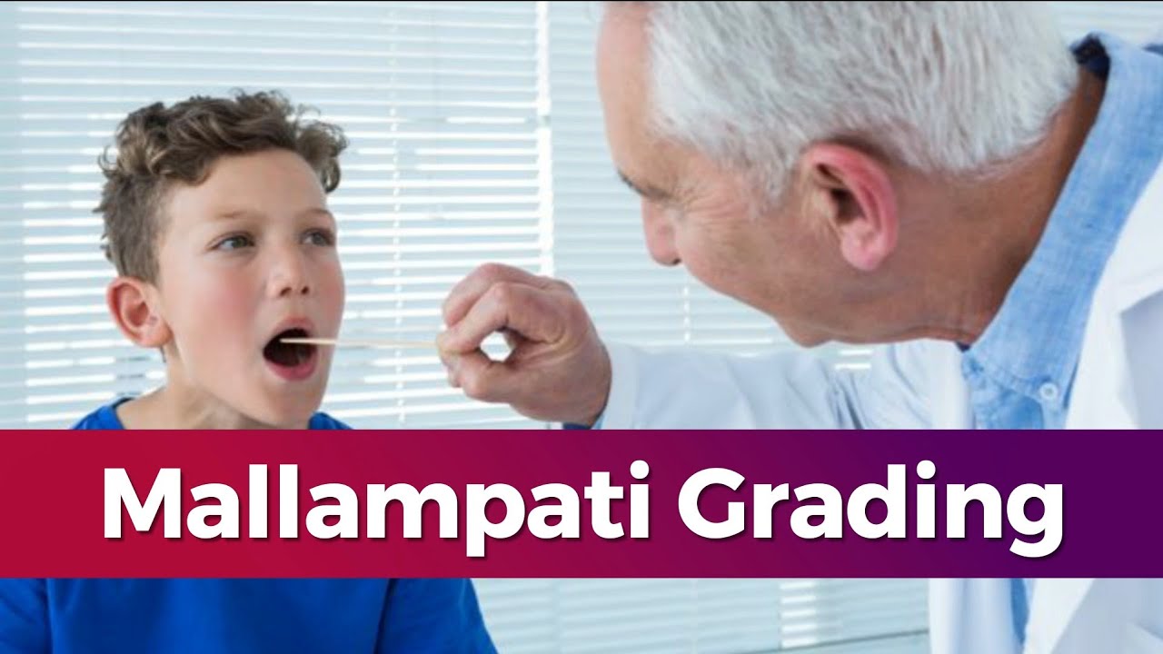 Mallampati Score| Mallampati classification |Mallampati Score ...