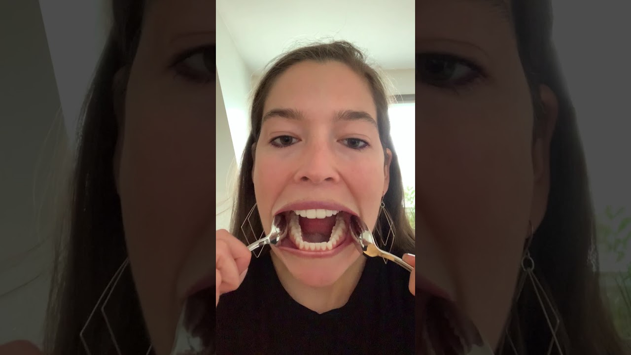 Dr Weaver Shows How to Take Photos of Your Teeth! - YouTube